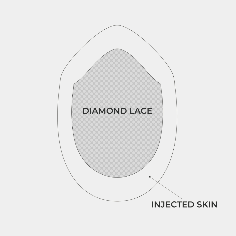 INL