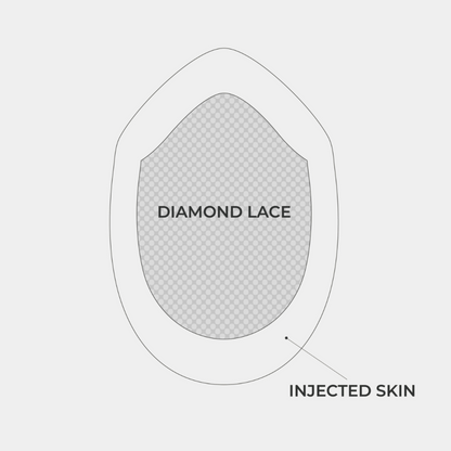 INL